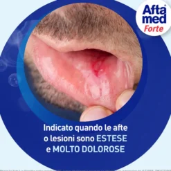 AFTAMED GEL FORTE SCUDO 8 ML