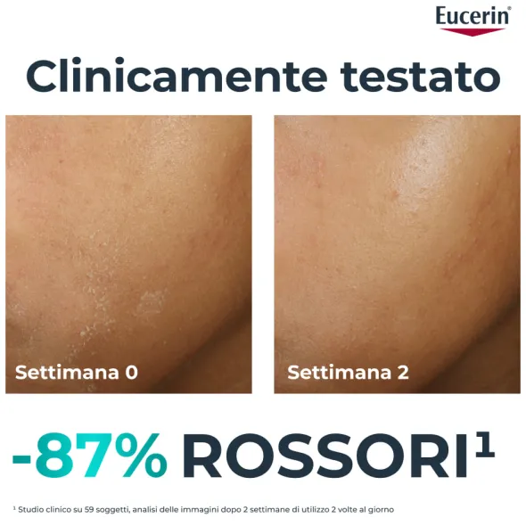Crema Eucerin DermoPure Trattamento Lenitivo, viso