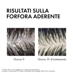 DERCOS SHAMPO ANTIFORFORA GRASSI 200 ML