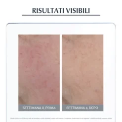 EUCERIN ANTIROSE GIORNO TRATTAMENTO NEUTRALIZZANTE SPF25 50 ML