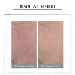 EUCERIN ANTIROSE TRATTAMENTO LENITIVO NOTTE50ML