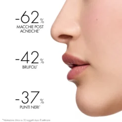 NORMADERM PHYTOSOLUTION TRATTAMENTO 50 ML