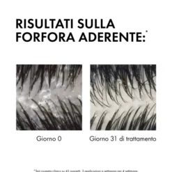 Shampoo Dercos Technique antiforfora capelli grassi