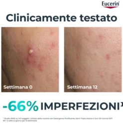 Siero Eucerin DermoPure Tripla Azione viso, 40ml