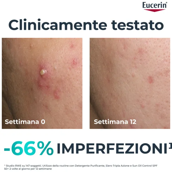 Siero Eucerin DermoPure Tripla Azione viso, 40ml